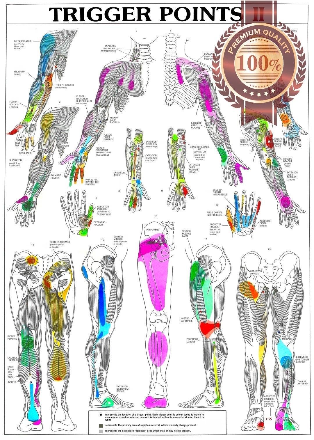 Trigger Points Part 2 Single Premium Waterproof Tear Proof Poster Anatomical Diagram Chart Guide Wall Diagram Art Print Etsy